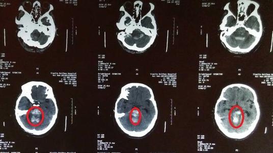 脑在线观看,探索大脑奥秘的数字之旅 第2张 脑在线观看,探索大脑奥秘的数字之旅 第2张